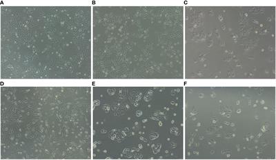 Depletion of the m1A writer TRMT6/TRMT61A reduces proliferation and resistance against cellular stress in bladder cancer